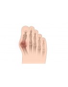 MAL AU PIED